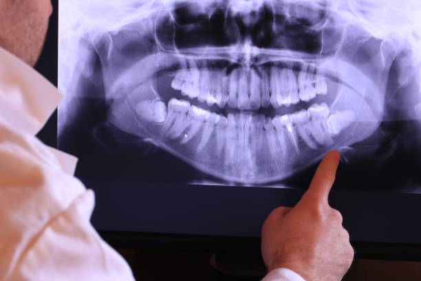 Best Emergency Dental Care for Broken or Chipped Teeth in Dakota Dunes, SD